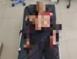 Geger….Ampah Berdarah, Lansia 79 Tahun Alami Luka Serius di Dada hingga Bahu