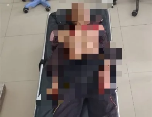 Geger….Ampah Berdarah, Lansia 79 Tahun Alami Luka Serius di Dada hingga Bahu