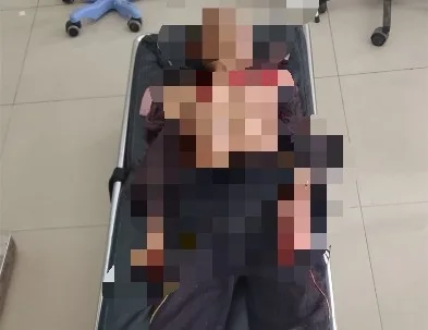 Geger….Ampah Berdarah, Lansia 79 Tahun Alami Luka Serius di Dada hingga Bahu